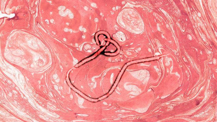 Microscopic Image of Ebola virus
