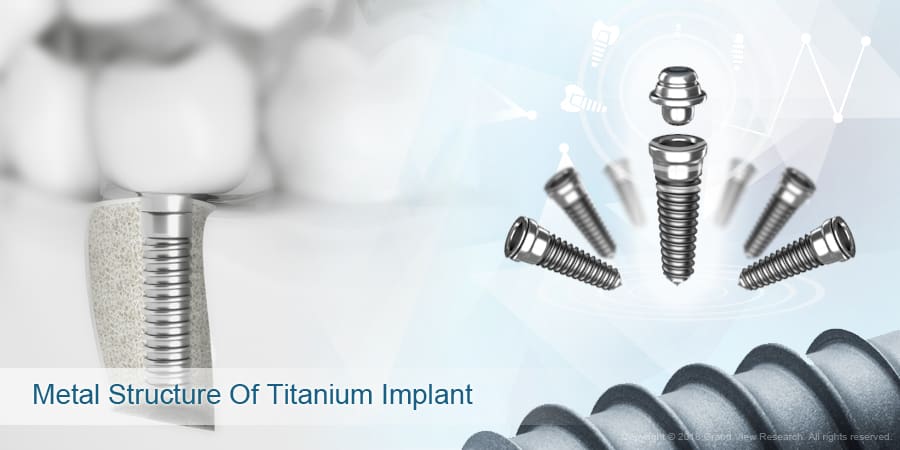Metal Structure Of Titanium Implant
