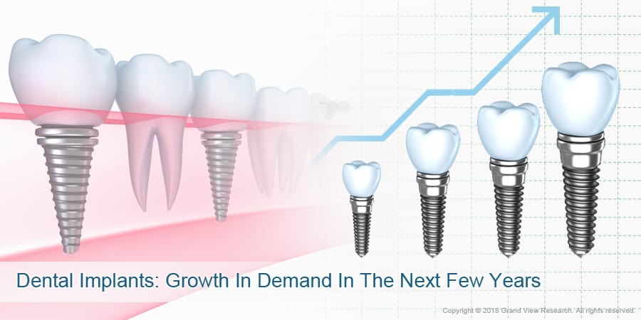 Dental Implants Growth In Demand In The Next Few Years