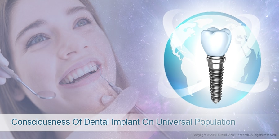 Consciousness Of Dental Implant On Universal Population