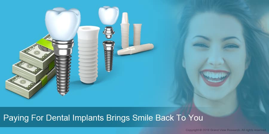 Paying For Dental Implants Brings Smile Back To You