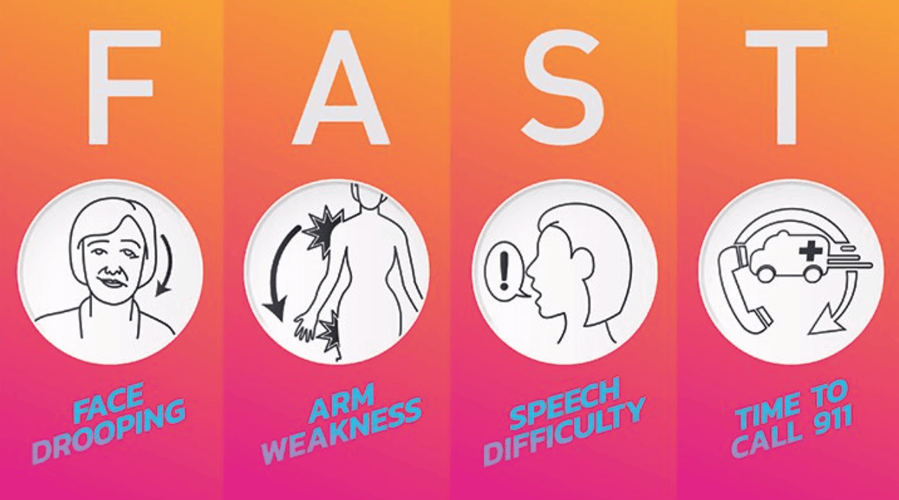 ai detect stroke